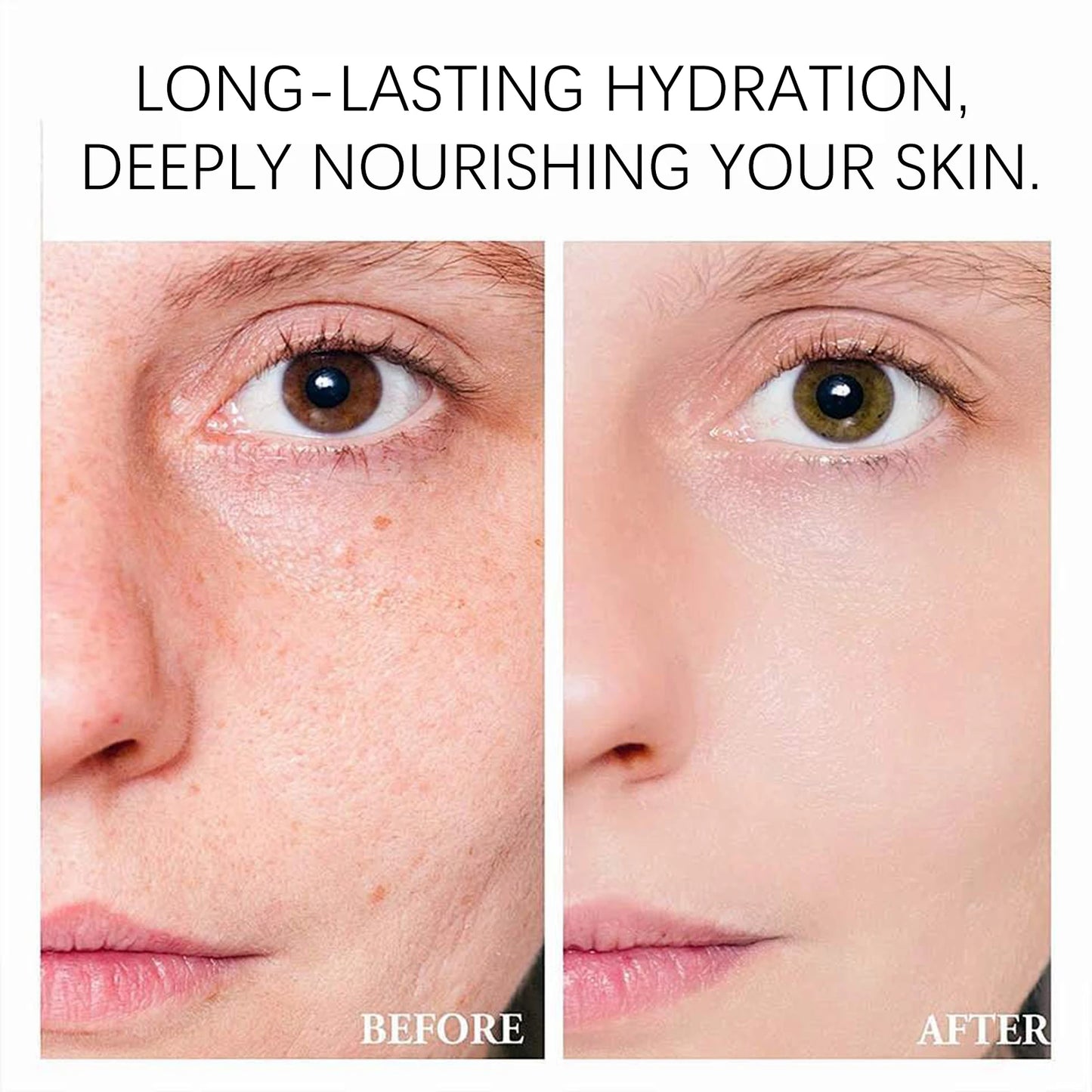 Niacinamide Face Cream, Minimizes Pores, Moisturizes, Suitable for Oily Skin, Effectively Hydrates