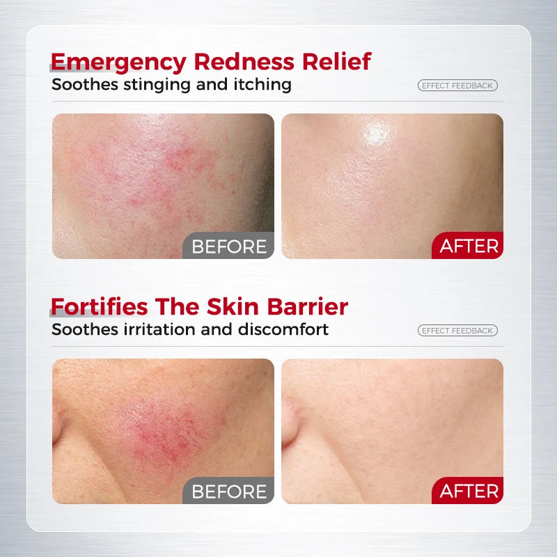 Hydrating Soothing Essence Cream – Collagen, Ceramides, Hyaluronic Acid & Plant Extracts for Moisture, Barrier Repair & Redness